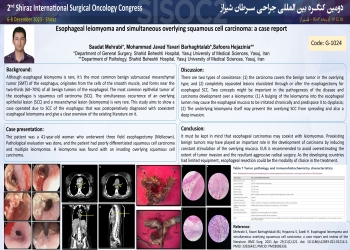 Esophageal leiomyoma and simultaneous overlying squamous cell carcinoma 